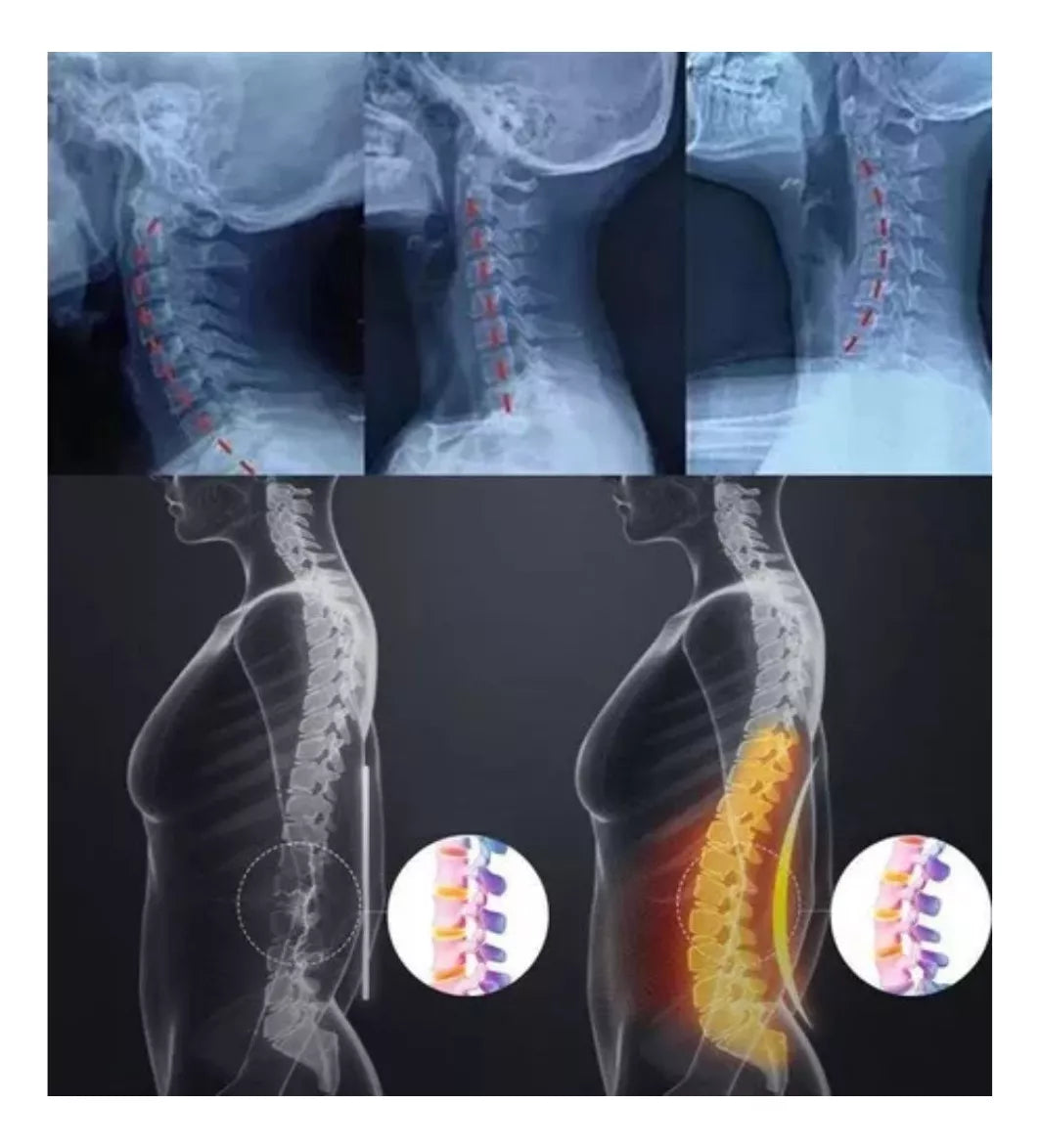 SOPORTE CUELLO ALMOHADA DE ESTIRAMIENTO gratis